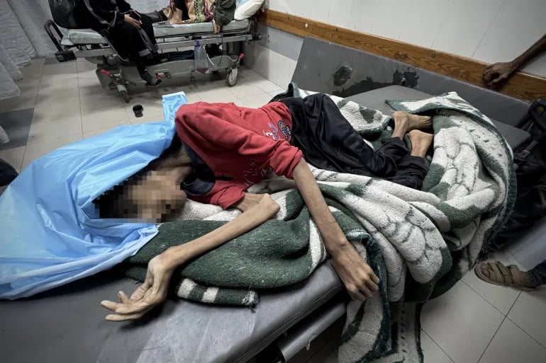 غزة: استشهاد الشابة رحيل رصرص (32 سنة) ووزنها 25 كيلوغراما