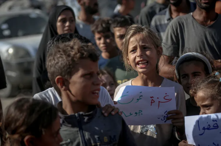 جراح بريطاني: أطفال غزة ينامون ببطون ممتلئة بالماء والملح!