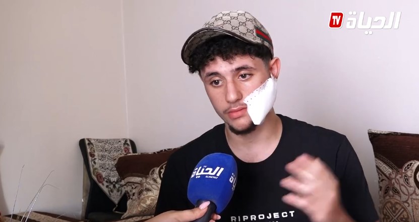 الاعتداء على شاب بـ”شفرة” في رغاية يهز مواقع التواصل