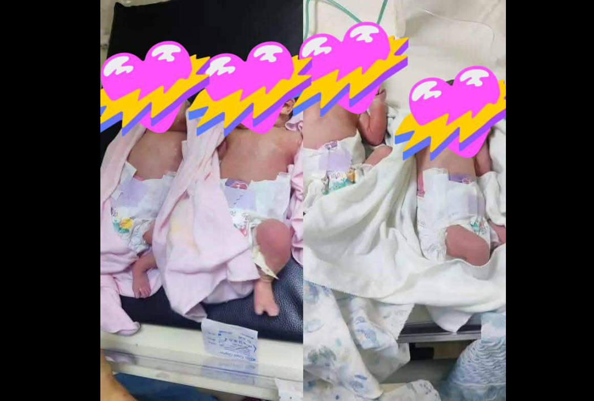 ولادة نادرة لأربعة توائم بالجلفة