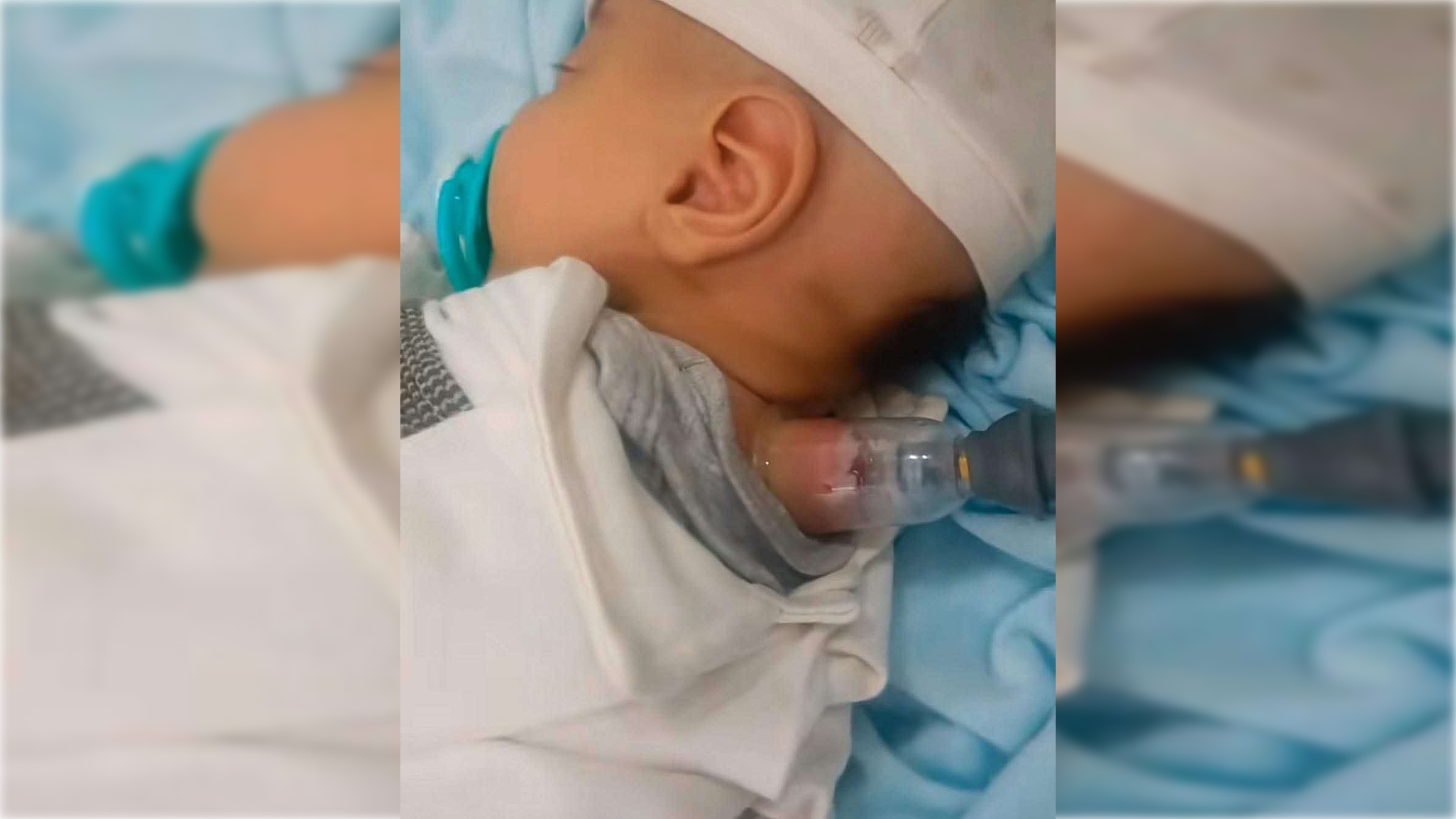 انتشار فيديو يوثق حجامة لرضيع يثير جدلاً واسعاً
